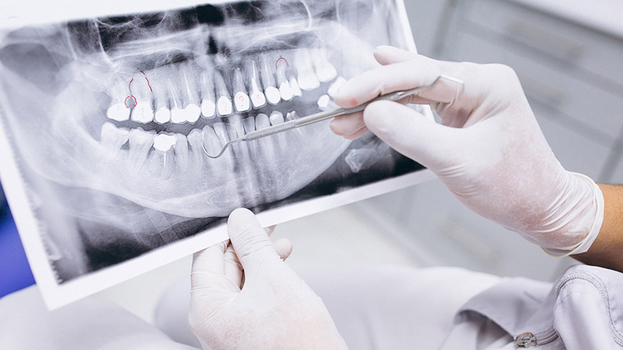 implantes dentales y protesis